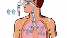 肺腑之言 | 在家也可以用呼吸机，该如何选择呢？