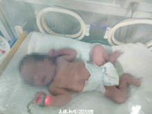 贵州省将军山医院第二位新冠肺炎确诊孕妇顺利分娩
