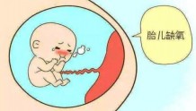 孕妈头晕一定就是胎宝宝缺氧吗？未必，这三个原因不能忽视