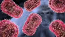 新冠疫情错误重演？猴痘正在人际传播，或致西方再现“医疗卫生鸿沟” | 国际观察