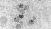 世卫组织公布猴痘病毒分支新命名：罗马数字和小写英文字母组成
