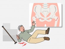 山东省立第三医院专家提醒：老年人“莫名”腰背痛，小心已经脊柱骨折了