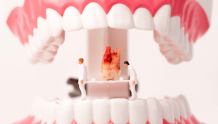 年纪不到，牙齿先掉？生活有哪些行为，可能是伤害牙齿的“祸根”