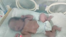 又一个新生命，诞生了！贵州省将军山医院第二位新冠肺炎确诊孕妇顺利分娩